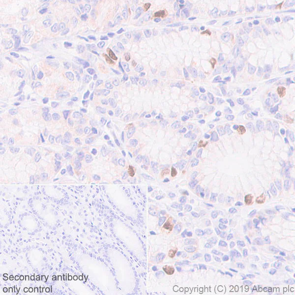 Immunohistochemistry (Formalin/PFA-fixed paraffin-embedded sections) - Anti-KIFC1 antibody [11445] (AB172620)