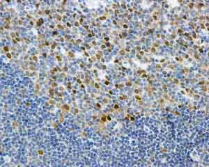 Immunohistochemistry (Formalin/PFA-fixed paraffin-embedded sections) - Anti-KIFC1 antibody [11445] (AB172620)