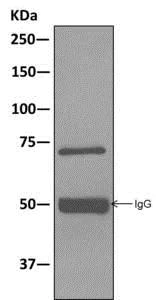Western blot - Anti-KIFC1 antibody [11445] (AB172620)