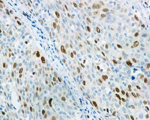 Immunohistochemistry (Formalin/PFA-fixed paraffin-embedded sections) - Anti-KIFC1 antibody [11445] - BSA and Azide free (AB235994)