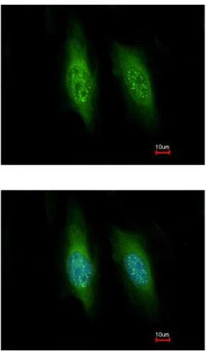 Immunocytochemistry/ Immunofluorescence - Anti-KIFC3 antibody (AB154419)