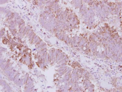 Immunohistochemistry (Formalin/PFA-fixed paraffin-embedded sections) - Anti-KIFC3 antibody (AB154419), expandable thumbnail