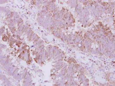 Immunohistochemistry (Formalin/PFA-fixed paraffin-embedded sections) - Anti-KIFC3 antibody (AB154419)