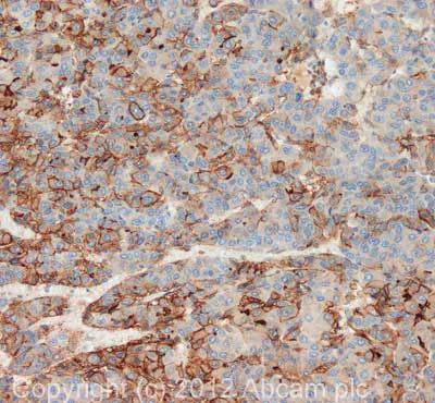 Immunohistochemistry (Formalin/PFA-fixed paraffin-embedded sections) - Anti-Kindlin-1 antibody (AB68041)