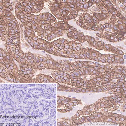 Immunohistochemistry (Formalin/PFA-fixed paraffin-embedded sections) - Anti-Kindlin 2 antibody [3A3.5] (AB254535)