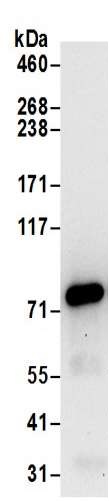 Immunoprecipitation - Anti-Kindlin 2 antibody (AB194967)