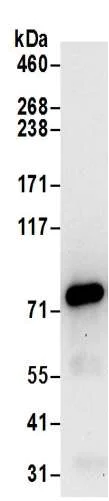 Immunoprecipitation - Anti-Kindlin 2 antibody (AB194967)