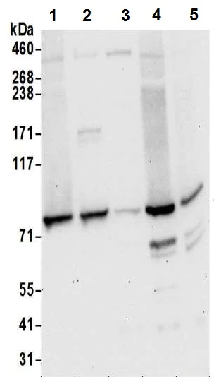 Western blot - Anti-Kindlin 2 antibody (AB194967)