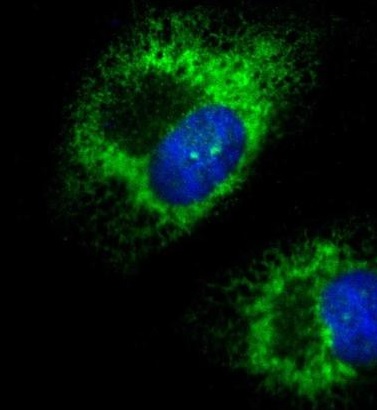 Immunocytochemistry/ Immunofluorescence - Anti-Kinectin 1 antibody (AB224324), expandable thumbnail