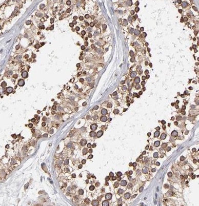 Immunohistochemistry (Formalin/PFA-fixed paraffin-embedded sections) - Anti-Kinectin 1 antibody (AB224324), expandable thumbnail