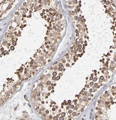 Immunohistochemistry (Formalin/PFA-fixed paraffin-embedded sections) - Anti-Kinectin 1 antibody (AB224324)