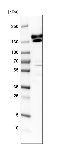 Western blot - Anti-Kinectin 1 antibody (AB224324), expandable thumbnail
