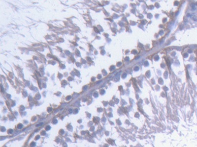 Immunohistochemistry (Formalin/PFA-fixed paraffin-embedded sections) - Anti-Kinectin 1 antibody (AB231002)