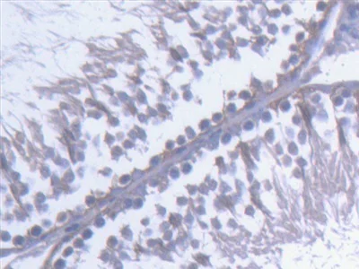 Immunohistochemistry (Formalin/PFA-fixed paraffin-embedded sections) - Anti-Kinectin 1 antibody (AB231002)