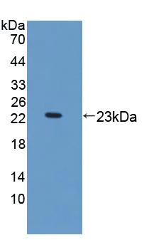 Western blot - Anti-Kinectin 1 antibody (AB231002)