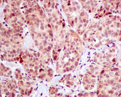 Immunohistochemistry (Formalin/PFA-fixed paraffin-embedded sections) - Anti-Kinesin Heavy Chain 2 antibody [EPR10740(B)] (AB154868), expandable thumbnail