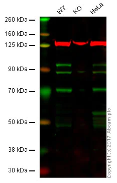 Western blot - Anti-Kinesin Heavy Chain 2 antibody [EPR10740(B)] (AB154868)