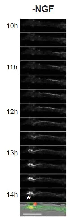 Functional Studies - Kinetic Apoptosis Kit (Microscopy) (AB129817)