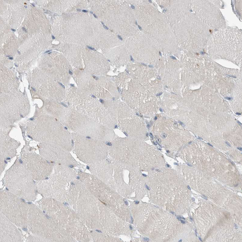 Immunohistochemistry (Formalin/PFA-fixed paraffin-embedded sections) - Anti-Kinetochore antibody (AB254630)