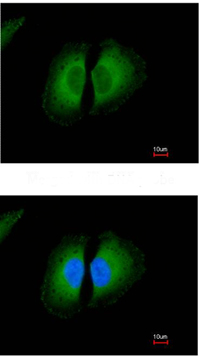 Immunocytochemistry/ Immunofluorescence - Anti-Kininogen 1 antibody (AB97761), expandable thumbnail