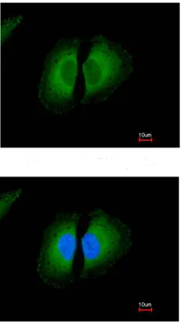 Immunocytochemistry/ Immunofluorescence - Anti-Kininogen 1 antibody (AB97761)