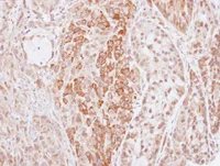 Immunohistochemistry (Formalin/PFA-fixed paraffin-embedded sections) - Anti-Kininogen 1 antibody (AB97761)