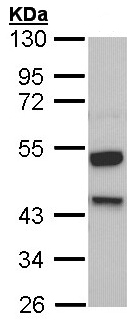 Western blot - Anti-Kininogen 1 antibody (AB97761), expandable thumbnail