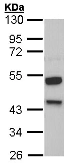 Western blot - Anti-Kininogen 1 antibody (AB97761)