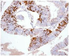 Immunohistochemistry (Formalin/PFA-fixed paraffin-embedded sections) - Anti-Kininogen 1 antibody [EPR6097] (AB124737)