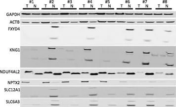 Western blot - Anti-Kininogen 1 antibody [EPR6097] (AB124737)