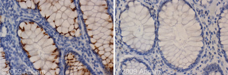 Immunohistochemistry (Formalin/PFA-fixed paraffin-embedded sections) - Anti-Kir2.1/KCNJ2 antibody (AB65796)
