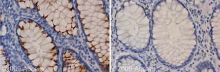 Immunohistochemistry (Formalin/PFA-fixed paraffin-embedded sections) - Anti-Kir2.1/KCNJ2 antibody (AB65796)