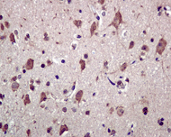 Immunohistochemistry (Formalin/PFA-fixed paraffin-embedded sections) - Anti-Kir2.1/KCNJ2 antibody [EPR4530] (AB109750), expandable thumbnail