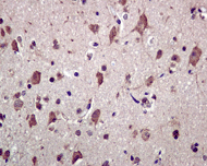 Immunohistochemistry (Formalin/PFA-fixed paraffin-embedded sections) - Anti-Kir2.1/KCNJ2 antibody [EPR4530] - BSA and Azide free (AB239988)