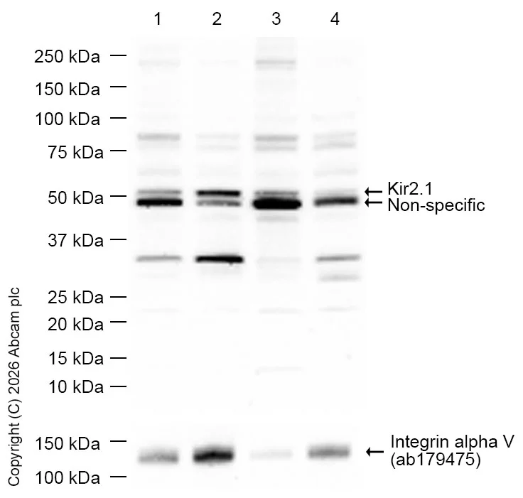 Western blot - Anti-Kir2.1/KCNJ2 antibody [EPR4530] - BSA and Azide free (AB239988)