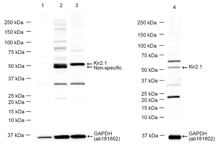 Western blot - Anti-Kir2.1/KCNJ2 antibody [EPR4530] - BSA and Azide free (AB239988)