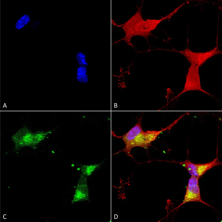 Immunocytochemistry/ Immunofluorescence - Anti-Kir2.1/KCNJ2 antibody [S112] (AB85492)