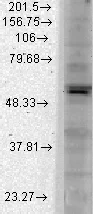 Western blot - Anti-Kir2.1/KCNJ2 antibody [S112] (AB85492)