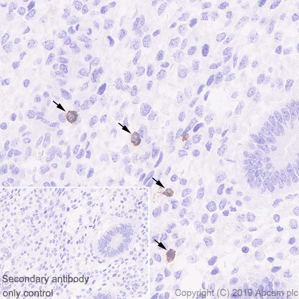 Immunohistochemistry (Formalin/PFA-fixed paraffin-embedded sections) - Anti-KIR2DL1 + KIR2DL2 antibody [EPR22492-2] (AB224696), expandable thumbnail