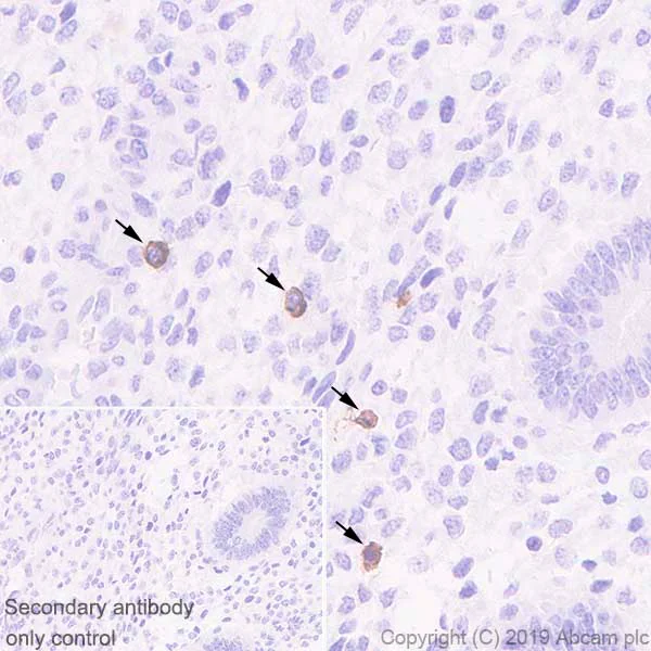 Immunohistochemistry (Formalin/PFA-fixed paraffin-embedded sections) - Anti-KIR2DL1 + KIR2DL2 antibody [EPR22492-2] (AB224696)