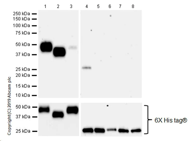 Western blot - Anti-KIR2DL1 + KIR2DL2 antibody [EPR22492-79] (AB252937)