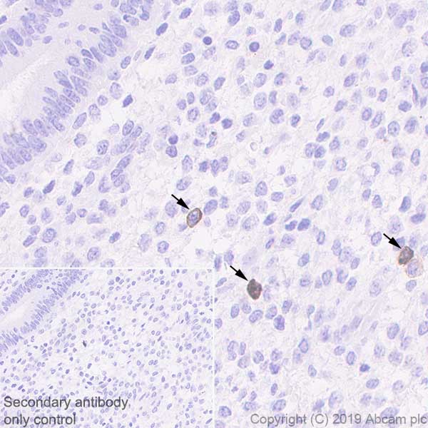 Immunohistochemistry (Formalin/PFA-fixed paraffin-embedded sections) - Anti-KIR2DL1 + KIR2DL2 antibody [EPR22492-79] - BSA and Azide free (AB255857), expandable thumbnail