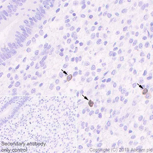 Immunohistochemistry (Formalin/PFA-fixed paraffin-embedded sections) - Anti-KIR2DL1 + KIR2DL2 antibody [EPR22492-79] - BSA and Azide free (AB255857)