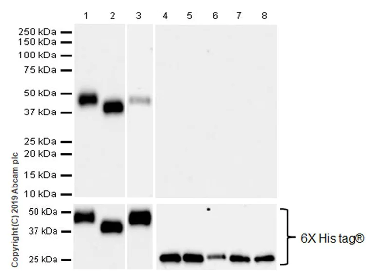 Western blot - Anti-KIR2DL1 + KIR2DL2 antibody [EPR22492-92] (AB252936)