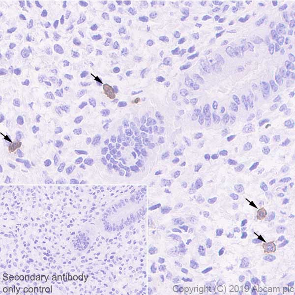 Immunohistochemistry (Formalin/PFA-fixed paraffin-embedded sections) - Anti-KIR2DL1 + KIR2DL2 antibody [EPR22492-92] - BSA and Azide free (AB255807), expandable thumbnail
