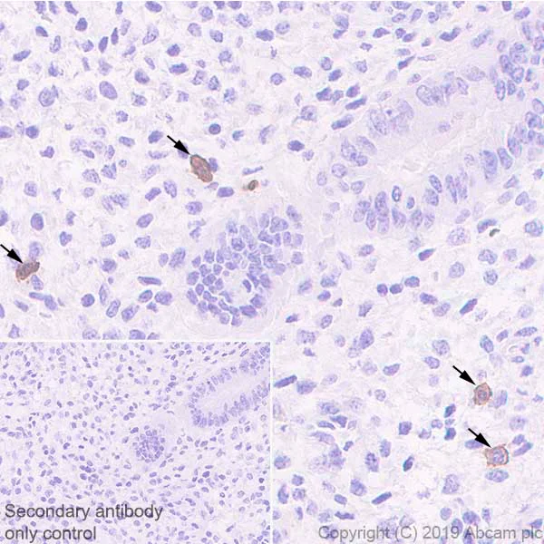 Immunohistochemistry (Formalin/PFA-fixed paraffin-embedded sections) - Anti-KIR2DL1 + KIR2DL2 antibody [EPR22492-92] - BSA and Azide free (AB255807)