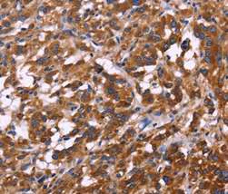 Immunohistochemistry (Formalin/PFA-fixed paraffin-embedded sections) - Anti-KIR2DL1 + KIR2DL3 + KIR2DL4 + KIR2DS4 antibody (AB197927)