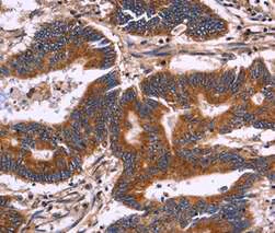 Immunohistochemistry (Formalin/PFA-fixed paraffin-embedded sections) - Anti-KIR2DL1 + KIR2DL3 + KIR2DL4 + KIR2DS4 antibody (AB197927)
