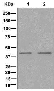 Western blot - Anti-KIR2DL3 antibody [EPR12281] - BSA and Azide free (AB250119)