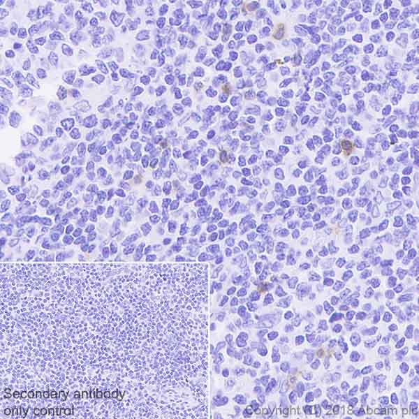 Immunohistochemistry (Formalin/PFA-fixed paraffin-embedded sections) - Anti-KIR2DL3 antibody [EPR22192] (AB225740)
